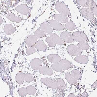 Immunohistochemistry-Paraffin: alcohol dehydrogenase 5 Antibody [NBP2-49350]
