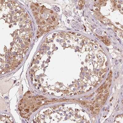 Immunohistochemistry-Paraffin: alcohol dehydrogenase 5 Antibody [NBP2-49350]