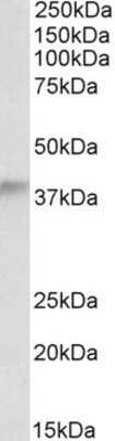 Western Blot: alcohol dehydrogenase 5 Antibody [NB100-57101]