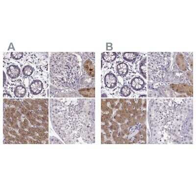 Immunohistochemistry-Paraffin: alcohol dehydrogenase 6 Antibody [NBP2-62658]