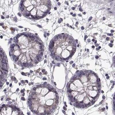 Immunohistochemistry-Paraffin: alcohol dehydrogenase 6 Antibody [NBP2-62658]