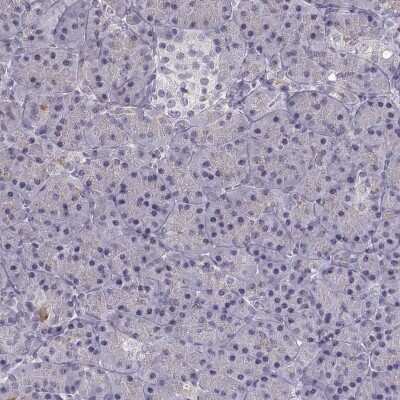 Immunohistochemistry-Paraffin: alcohol dehydrogenase 6 Antibody [NBP2-62661]