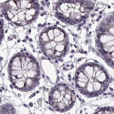 Immunohistochemistry-Paraffin: alcohol dehydrogenase 6 Antibody [NBP2-62661]