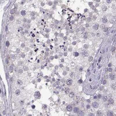 Immunohistochemistry-Paraffin: alcohol dehydrogenase 6 Antibody [NBP2-62661]