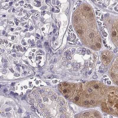 Immunohistochemistry-Paraffin: alcohol dehydrogenase 6 Antibody [NBP2-62661]