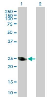 Western Blot: alcohol dehydrogenase 6 Antibody [H00000130-D01P]