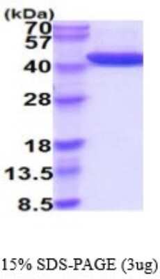SDS-PAGE: Recombinant Human alcohol dehydrogenase His Protein [NBP2-53077]
