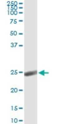 Immunoprecipitation: alpha 1-Acid Glycoprotein Antibody (2F9-1F10) [H00005004-M01]