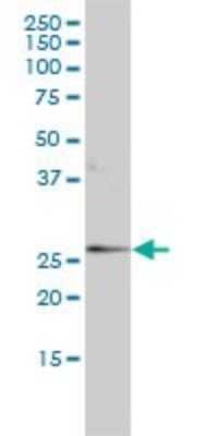 Western Blot: alpha 1-Acid Glycoprotein Antibody (2F9-1F10) [H00005004-M01]
