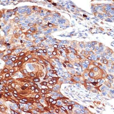 Immunohistochemistry-Paraffin: alpha 1-Acid Glycoprotein Antibody (9L2J6) [NBP3-15790]