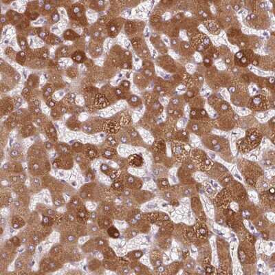 Immunohistochemistry: alpha 1-Acid Glycoprotein Antibody [NBP2-49266]