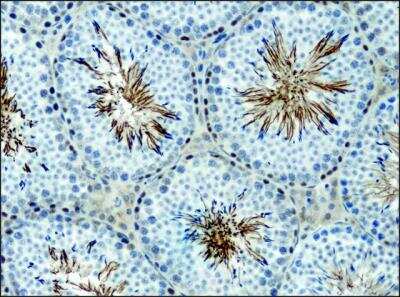 Immunohistochemistry: alpha 1 Mannosidase 1A Antibody [NB600-977]