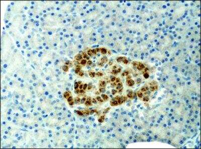 Immunohistochemistry: alpha 1 Mannosidase 1A Antibody [NB600-977]