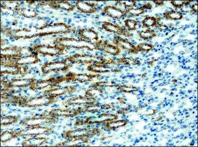 Immunohistochemistry: alpha 1 Mannosidase 1A Antibody [NB600-977]