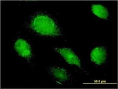 Immunocytochemistry/ Immunofluorescence: alpha 1-Microglobulin Antibody (3F1) [H00000259-M01]