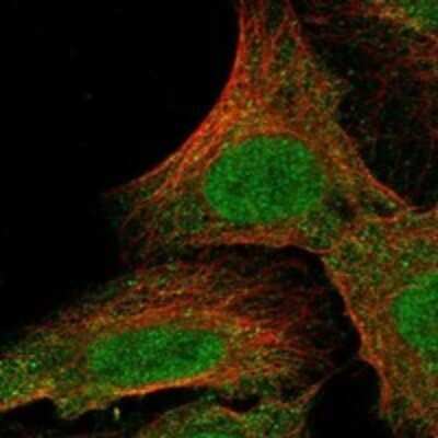 Immunocytochemistry/ Immunofluorescence: alpha-1A Adrenergic R/ADRA1A Antibody [NBP3-17211]