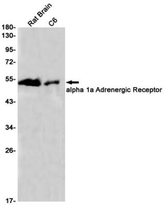 Western Blot: alpha-1A Adrenergic R/ADRA1A Antibody (S04-8B8) [NBP3-19566]