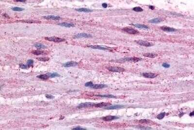 Immunohistochemistry-Paraffin: alpha-1B Adrenergic R/ADRA1B Antibody - BSA Free [NBP1-02325]