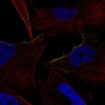 Immunocytochemistry/ Immunofluorescence: alpha-1B Adrenergic R/ADRA1B Antibody [NBP2-57288]