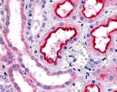 Immunohistochemistry-Paraffin: alpha-1B Adrenergic R/ADRA1B Antibody - BSA Free [NLS698]
