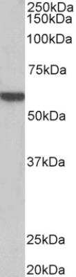 Western Blot: alpha-1B Adrenergic R/ADRA1B Antibody [NBP2-26181]