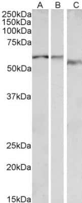 Western Blot: alpha-1B Adrenergic R/ADRA1B Antibody [NBP2-26181]