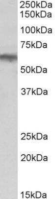 Western Blot: alpha-1B Adrenergic R/ADRA1B Antibody [NBP2-26182]