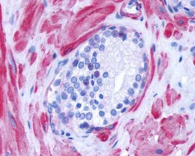 Immunohistochemistry-Paraffin: alpha-1D Adrenergic R/ADRA1D Antibody - BSA Free [NLS12]