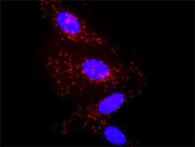 Proximity Ligation Assay: alpha 2-Macroglobulin Antibody (2B5) [H00000002-M03]