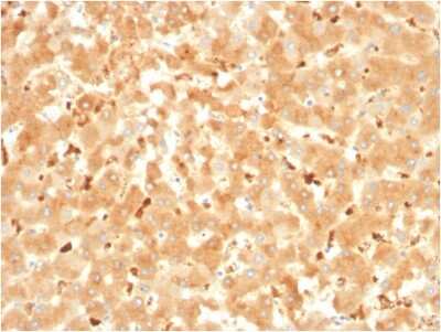 Immunohistochemistry-Paraffin: alpha 2-Macroglobulin Antibody (A2M/3621) [NBP3-07709]