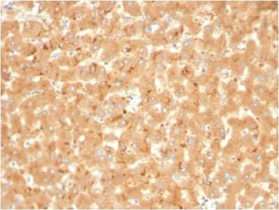 Immunohistochemistry-Paraffin: alpha 2-Macroglobulin Antibody (A2M/3623) - Azide and BSA Free [NBP3-08689]
