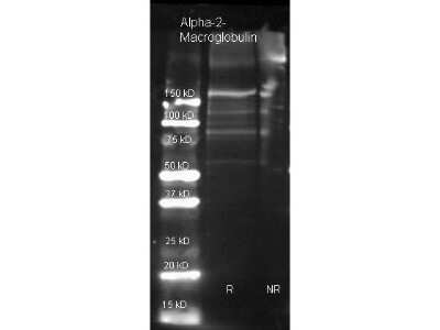 Western Blot: alpha 2-Macroglobulin Antibody [NB600-938]