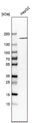 Western Blot: alpha 2-Macroglobulin Antibody [NBP1-85491]