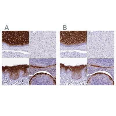 Immunohistochemistry-Paraffin: alpha 2-Macroglobulin-like 1/A2ML1 Antibody [NBP1-84392]