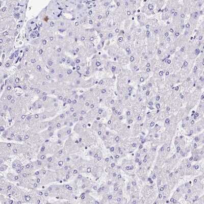 Immunohistochemistry-Paraffin: alpha 2-Macroglobulin-like 1/A2ML1 Antibody [NBP1-84392]