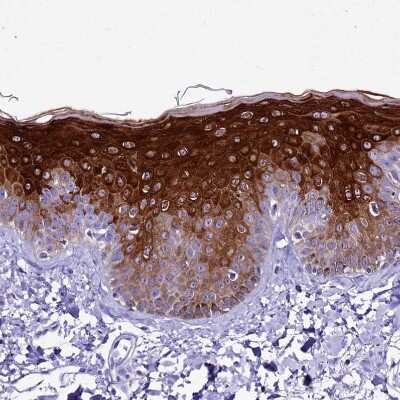 Immunohistochemistry-Paraffin: alpha 2-Macroglobulin-like 1/A2ML1 Antibody [NBP1-84392]