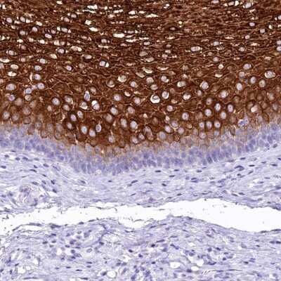 Immunohistochemistry-Paraffin: alpha 2-Macroglobulin-like 1/A2ML1 Antibody [NBP2-32647]