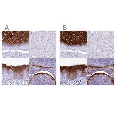 Immunohistochemistry-Paraffin: alpha 2-Macroglobulin-like 1/A2ML1 Antibody [NBP2-32647]