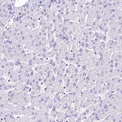 Immunohistochemistry-Paraffin: alpha 2-Macroglobulin-like 1/A2ML1 Antibody [NBP2-32647]