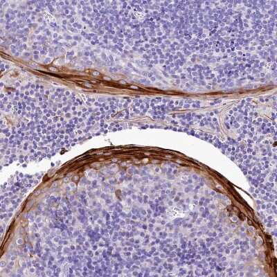 Immunohistochemistry-Paraffin: alpha 2-Macroglobulin-like 1/A2ML1 Antibody [NBP2-32647]