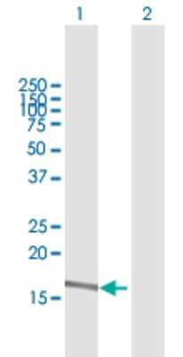 Western Blot: alpha 2-Macroglobulin-like 1/A2ML1 Antibody [H00144568-B01P]