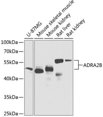 Western Blot: alpha-2B Adrenergic R/ADRA2B AntibodyBSA Free [NBP2-92556]