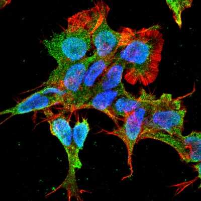 Immunocytochemistry/ Immunofluorescence: alpha-2C Adrenergic R/ADRA2C Antibody (S330A-80) [NBP2-22397]