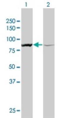 Western Blot: alpha-Actinin 1 Antibody (3F1) [H00000087-M01]