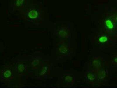 Immunocytochemistry/ Immunofluorescence: alpha-Actinin 1 Antibody (OTI7A4) [NBP1-48251]