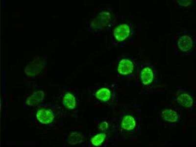 Immunocytochemistry/ Immunofluorescence: alpha-Actinin 1 Antibody (OTI7A4) [NBP1-48251]