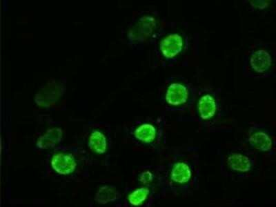 Immunocytochemistry/ Immunofluorescence: alpha-Actinin 1 Antibody (OTI7A4) - Azide and BSA Free [NBP2-70078]