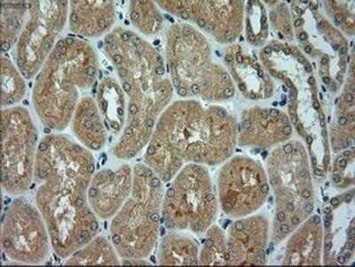 Immunohistochemistry: alpha-Actinin 1 Antibody (OTI7A4) - Azide and BSA Free [NBP2-70078]