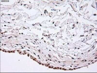 Immunohistochemistry: alpha-Actinin 1 Antibody (OTI7A4) - Azide and BSA Free [NBP2-70078]