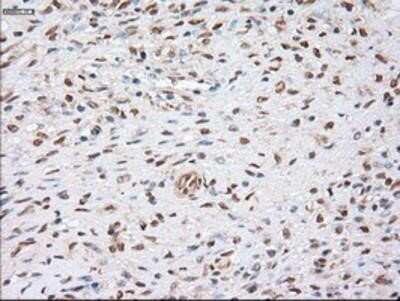 Immunohistochemistry: alpha-Actinin 1 Antibody (OTI7A4) - Azide and BSA Free [NBP2-70078]
